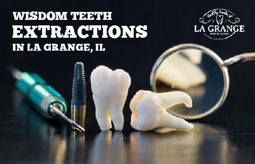 Wisdom Teeth Extractions in La Grange, IL
