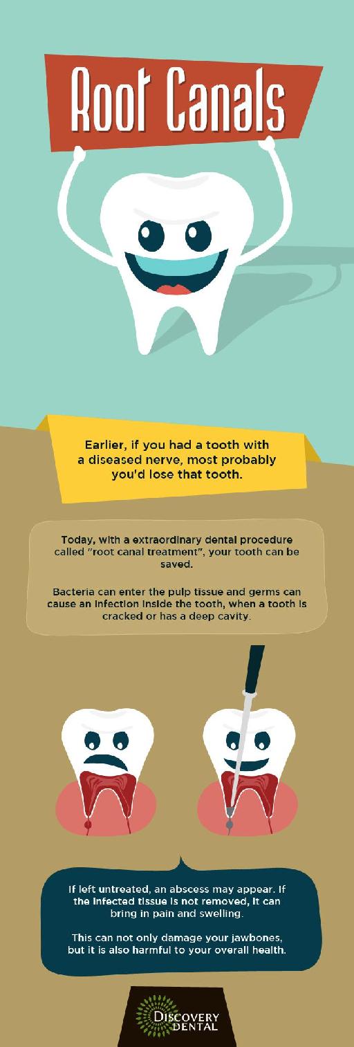 Effective Root Canal Treatment in Issaquah