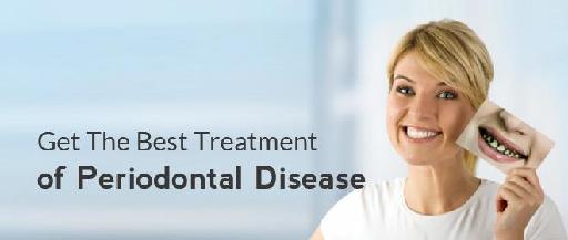 Get The Best Treatment of Periodontal Disease