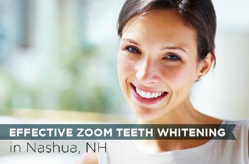 Effective Zoom Teeth Whitening in Nashua, NH