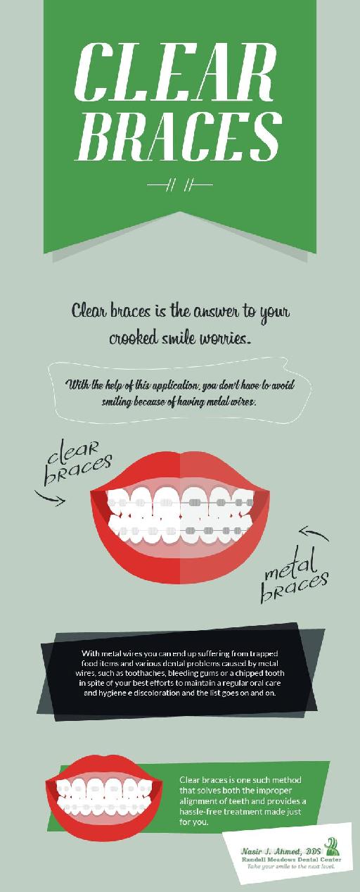 Get Clear Teeth Braces at Randall Meadows Dental Center