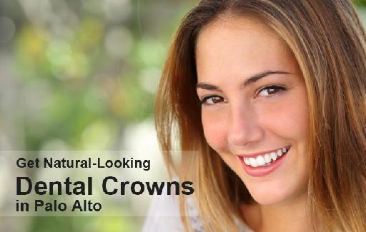 Get Natural-Looking Dental Crowns in Palo Alto