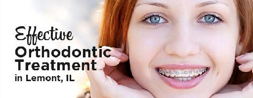 Effective Orthodontic Treatment in Lemont, IL