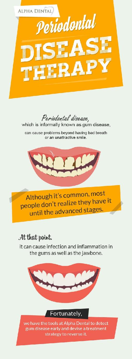 Get Treatment for Periodontal Disease at Alpha Dental