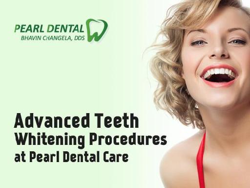 Advanced Teeth Whitening Procedures at Pearl Dental Care