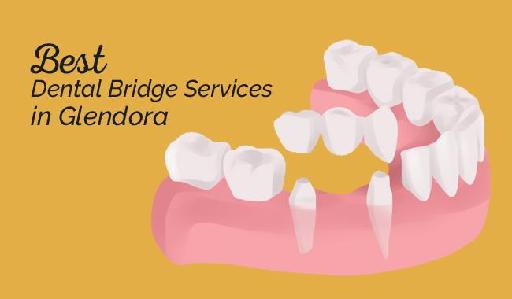 Best Dental Bridge Services in Glendora