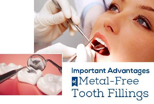 Important Advantages of Metal-Free Tooth Fillings