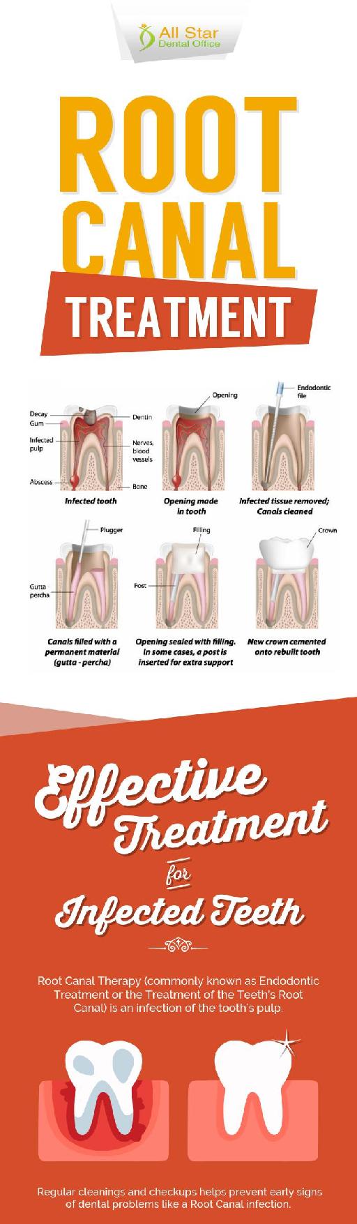 Root Canal Therapy - An Effective Treatment for Infected Teeth