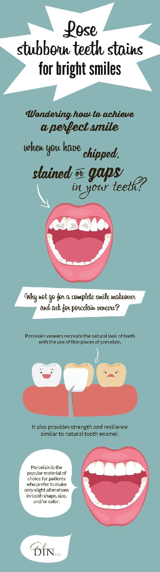Recreate the Natural Look of Teeth with Porcelain Veneers