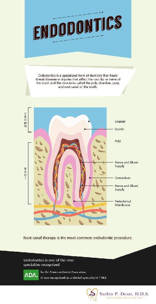 Endodontic Procedure - Root Canal Therapy