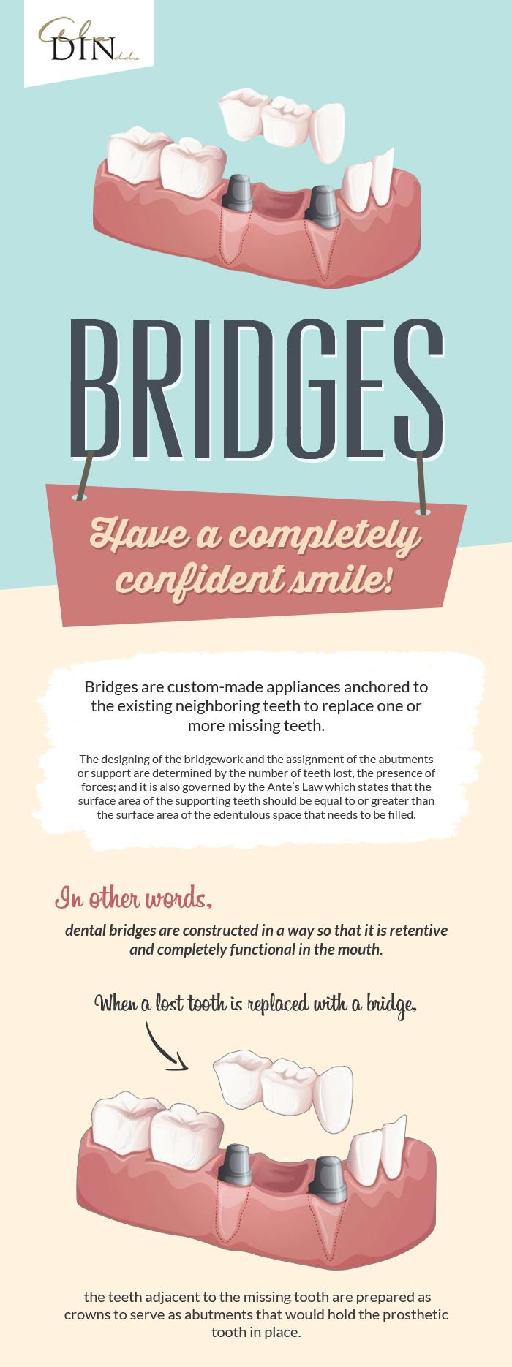 Quality Dental Bridges to Restore Your Confident Smile