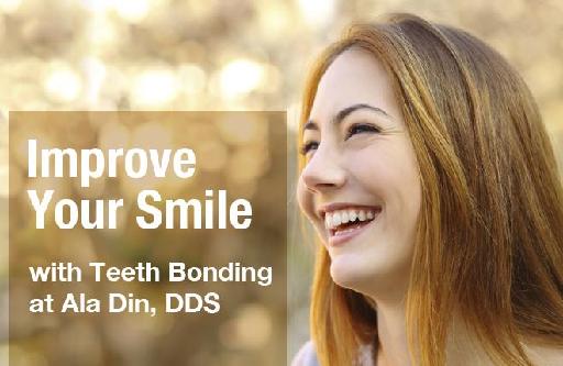 Improve Your Smile with Teeth Bonding at Ala Din, DDS